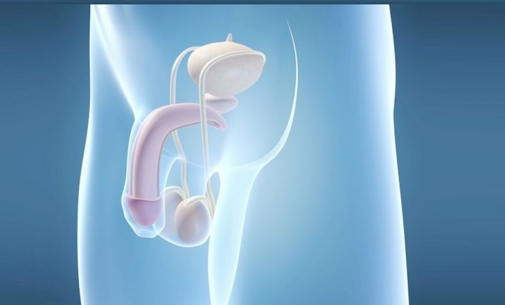 Protez implantasyonu erkek penisini büyütmenin cerrahi bir yöntemidir